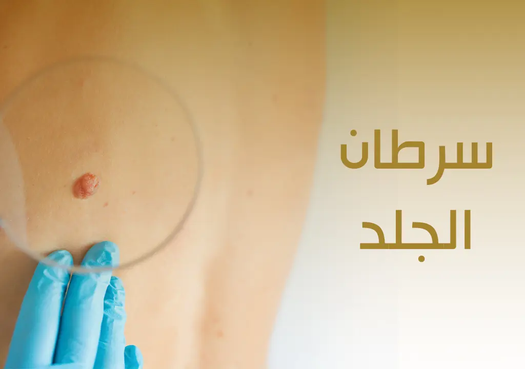 سرطان الجلد