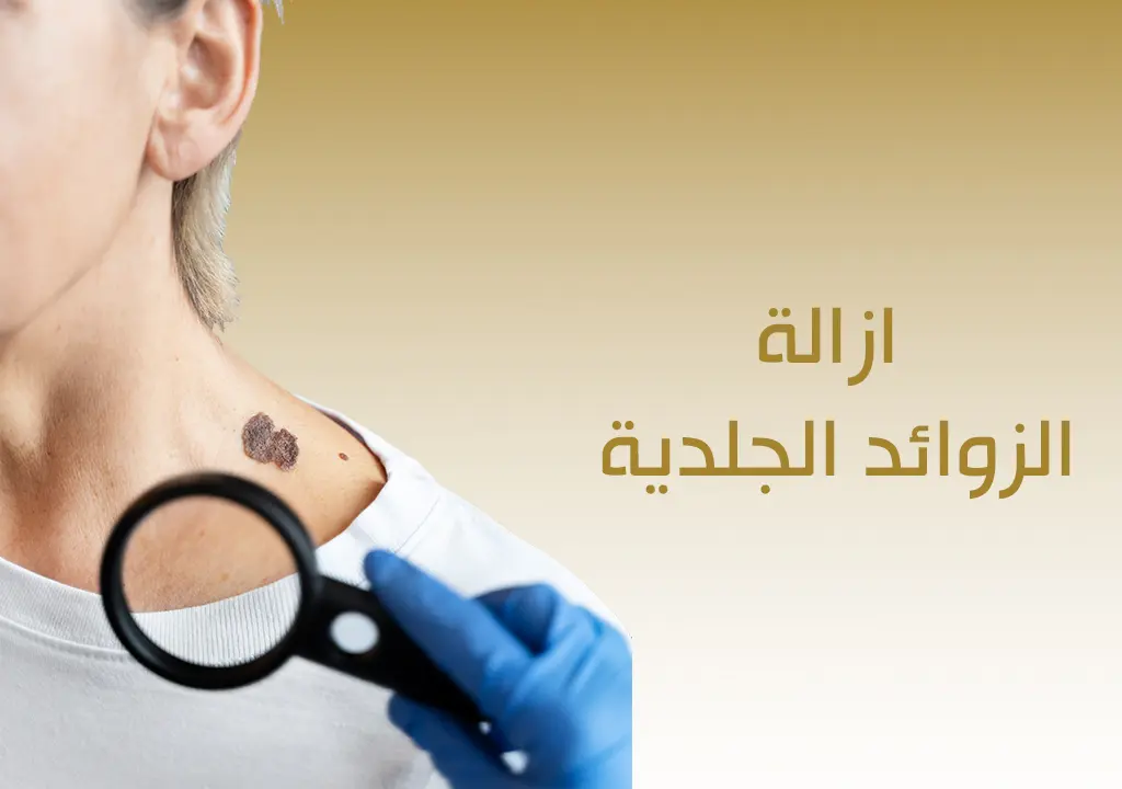 ازالة الزوائد الجلدية