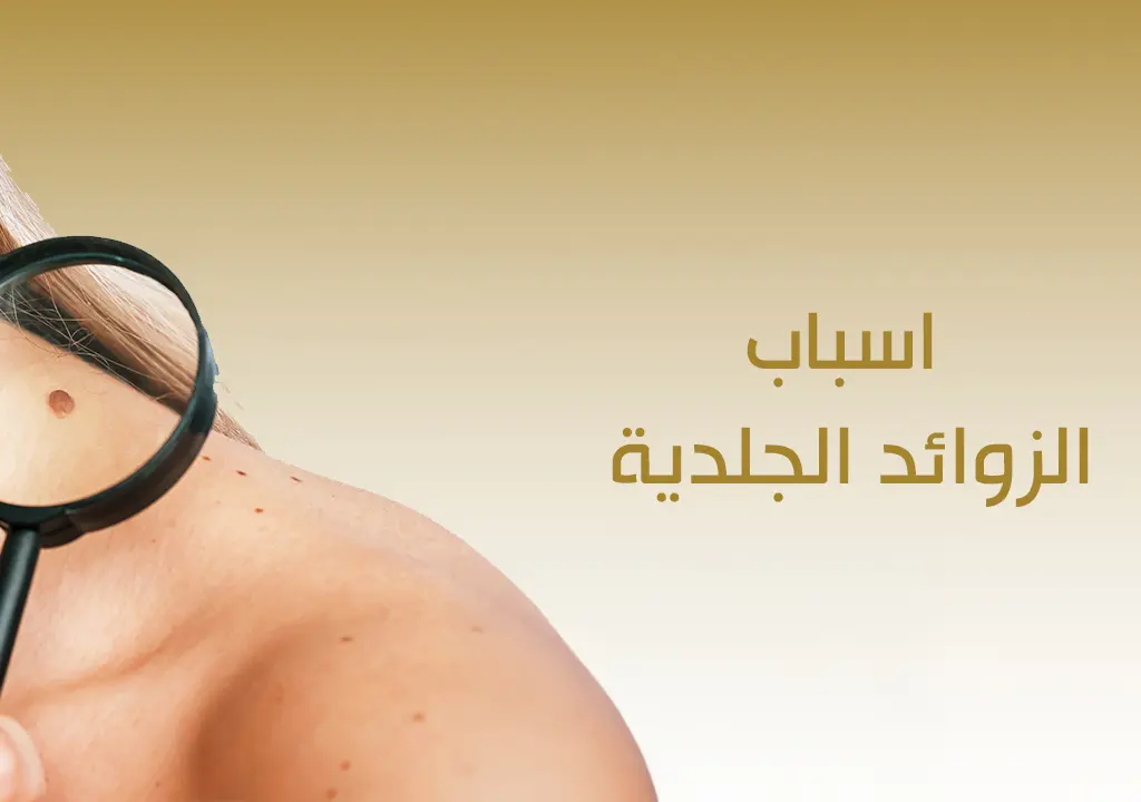 اسباب الزوائد الجلدية