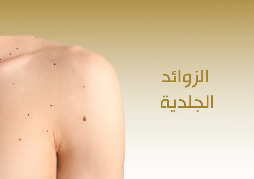 الزوائد الجلدية