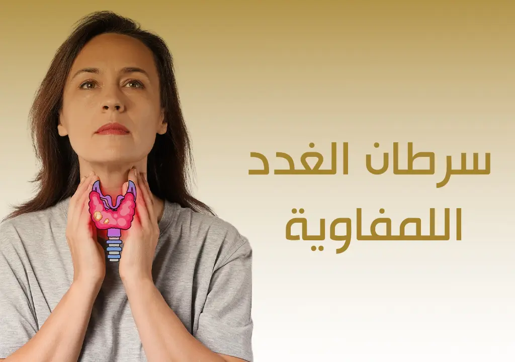 سرطان الغدد اللمفاوية