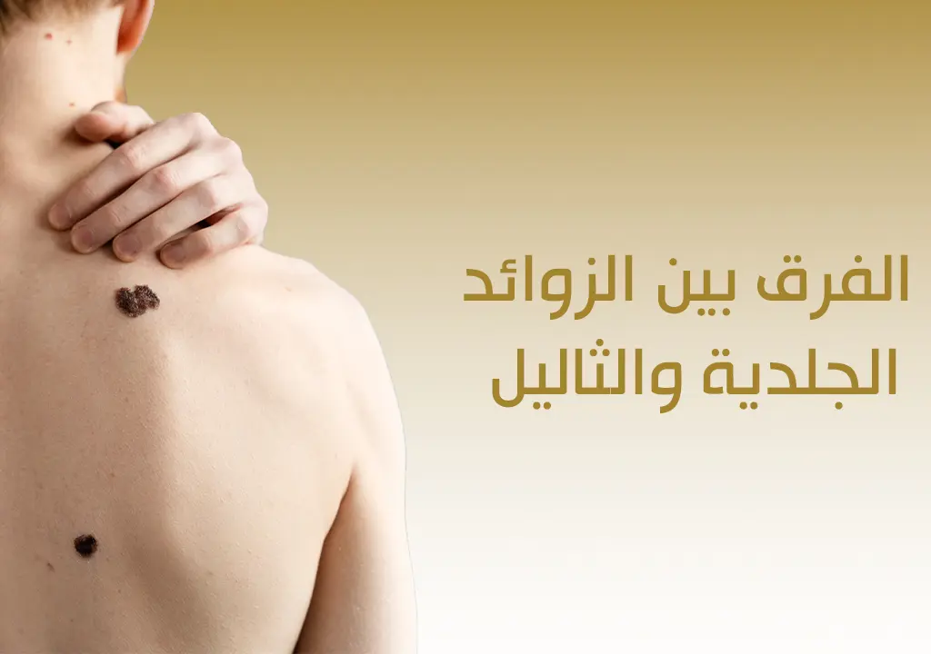 الفرق بين الزوائد الجلدية والثاليل