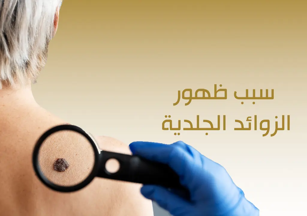 سبب ظهور الزوائد الجلدية